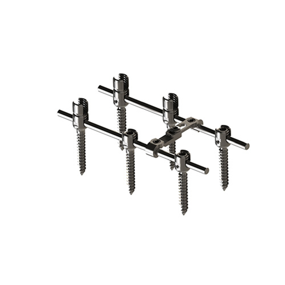 Spinal Pedicle Screw