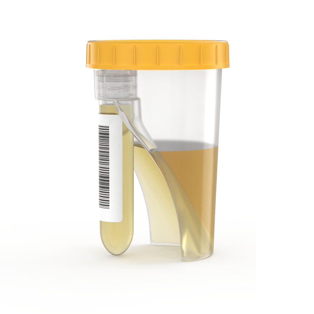 TUBYCON Single Tube Urine Test Cup Kit
